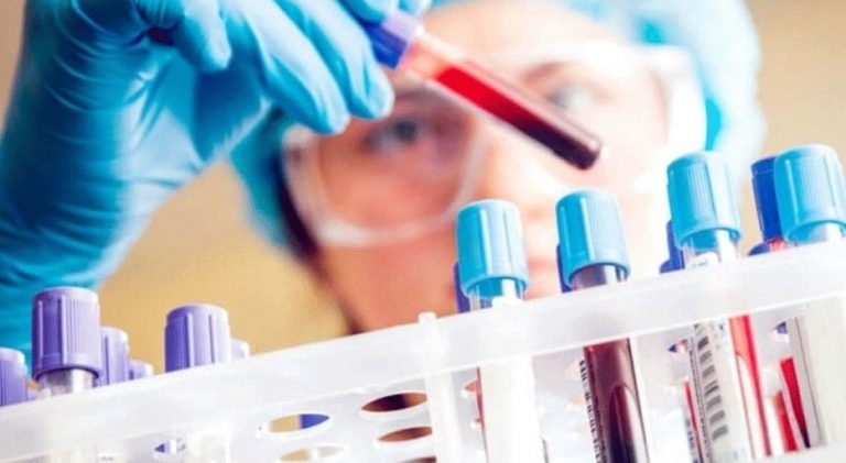 mp-rapid-antigen-test-preparation