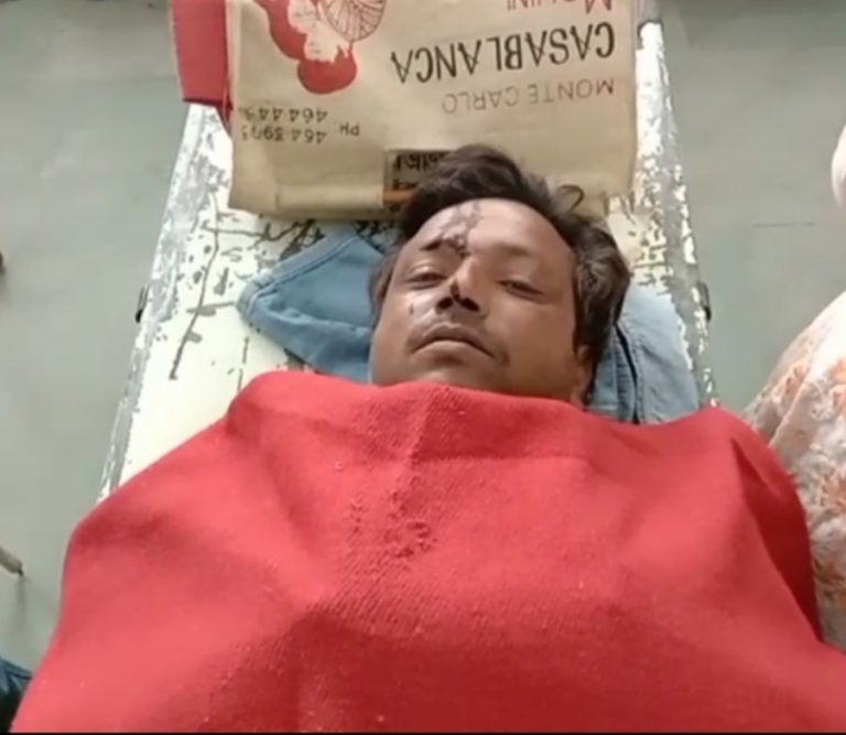 आपसी रंजिश में दुकान में घुसकर दो भाइयों की मारपीट, दहशत फैलाने एक भाई को मारी गोली