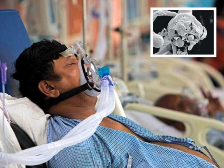 ब्लैक फंगस के खतरा मरीजों की आंत में मिला संक्रमण, दिखाई देते हैं ये लक्षण