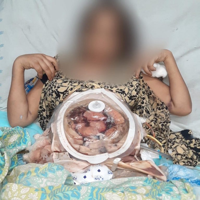 महिला को एसिड पिलाने का मामला; पति को छोड़ने की कर रही है मांग, महिला ने किया वीडियो जारी