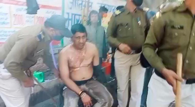 कांग्रेसियों के हंगामें में सब इंस्पेक्टर जला, सरकार का पुतला बचाने के कारण जला