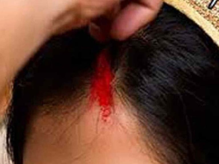 प्रेमी ने भरी दुल्हन की मांग, तो दूल्हे ने खुद पर किया चाकू से बार