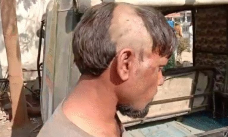 MP युवक को फिर दी तालिबानी सजा, गांव में निकाला इस तरीके का जुलूस