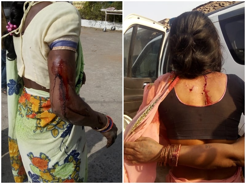 तेंदूआं ने महुआ बीनने गए तीन ग्रामीणों पर किया हमला