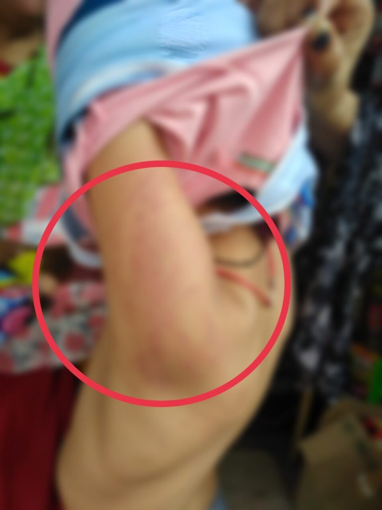 हाथ से पेंसिल गिरने पर स्कूल प्रिंसिपल ने मासूम बच्चे को डंडों से पीटा