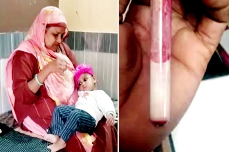 MP में डेढ़ साल की मासूम बच्ची का खून लाल की जगह निकाला सफेद‌