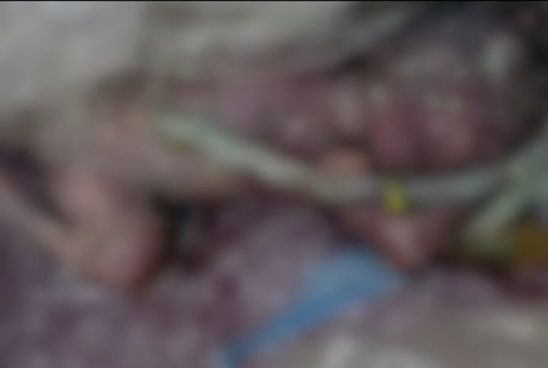 कचरी गाड़ी में फेंका नवजीत बच्ची का शव, पुलिस कर रही मां की तलाश