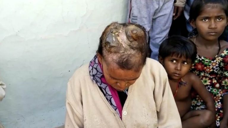 महिला के सिर से निकले सींग, आप भी देख रह जाएंगे हैरान