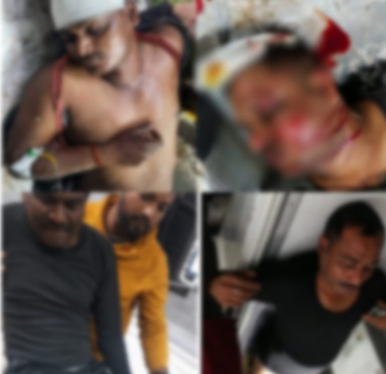 पेड़ से टकराया पुलिस वाहन, ASI समेत 4 पुलिस कर्मी घायल