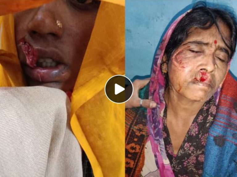 सियार ने एक बालिका सहित दो महिलाओं पर किया हमला