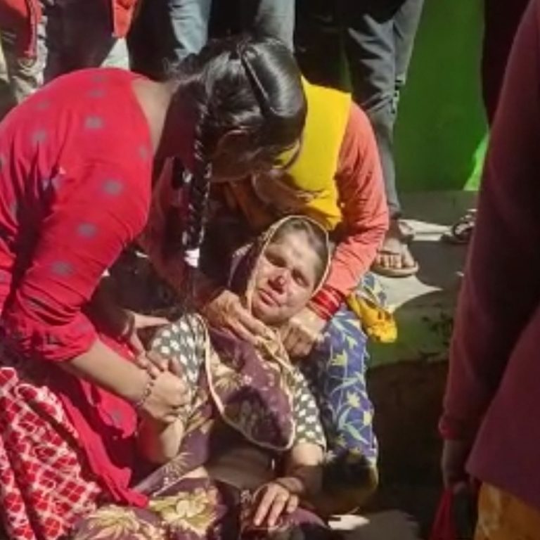 पति ने पत्नी की काट दी नाक, ये है पूरा मामला