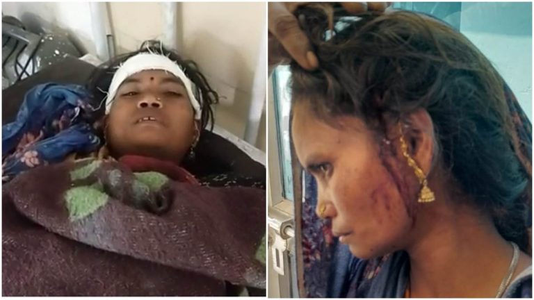 बाल बाल बची जान, महिला पर बाघ के शावक ने किया हमला
