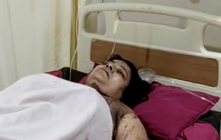 महिला ने प्रेमी के पत्नी के ऊपर फेंका तेजाब, पुलिस ने दर्ज किया क्रॉस मामला