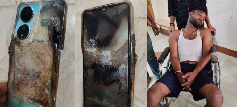 जीजी के घर बाइक से जा रहे युवक का मोबाइल फट, गंभीर रूप से घायल