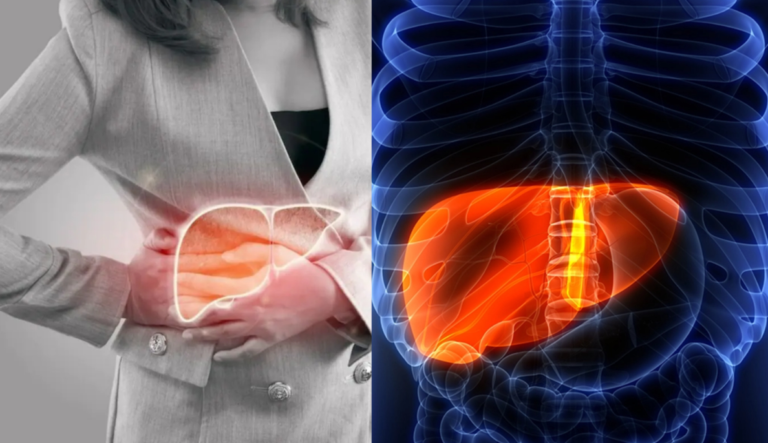 Liver खराब होने पर शरीर में नजर आते हैं ये लक्षण