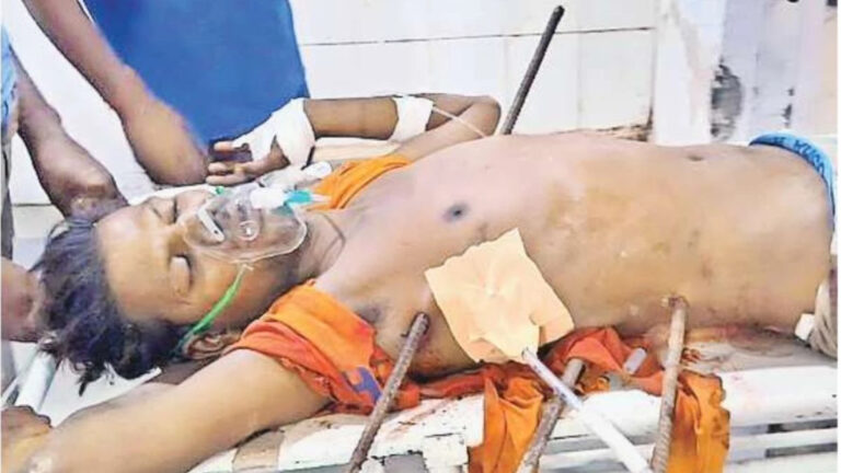 इलाज के दौरान मौत, छाती और पेट में फंसे थे 3 सरिये