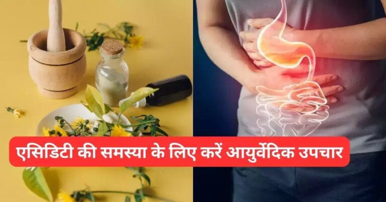 एसिडिटी होगी छूमंतर, आजमाएं आयुर्वेद के ये 5 रामबाण उपाय