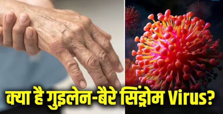 गुइलेन-बैरे सिंड्रोम से पहली मौत, 101 एक एक्टिव मरीज