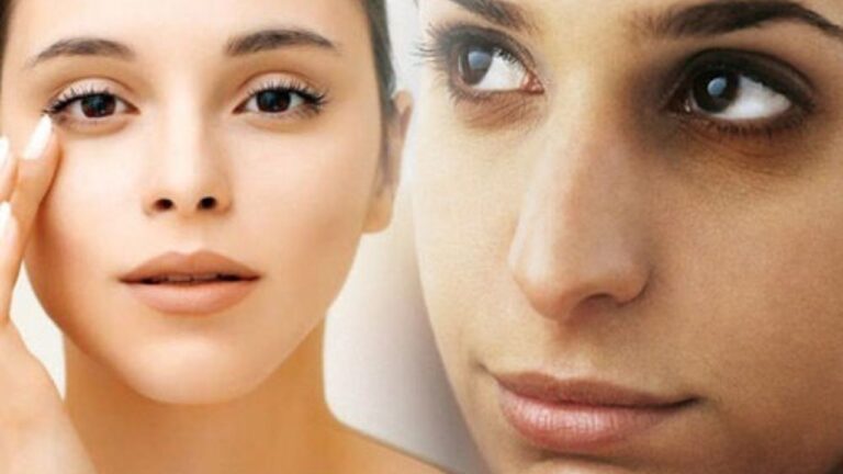 Dark circles: डार्क सर्कल्स का सच जानकर चौंक जाएंगे आप कुछ आदतें बनाती हैं चेहरा बूढ़ा और थका हुआ