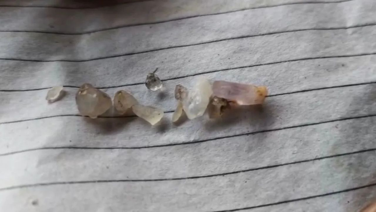 MP News: हीरे की खोज ने बदली किस्मत! जब मजदूर दंपति की किस्मत ने ली करवट