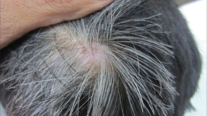 Grey Hair In Kids: क्या बालों की सफेदी छीन रही है आपके बच्चे की मासूमियत? एक छोटी सी गलती पड़ सकती है भारी।