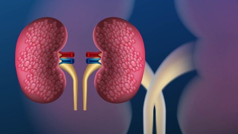 Kidney Damage: किडनी फेल होने से पहले देता है ये 5 संकेत! जानिए खुद को कैसे बचाएं