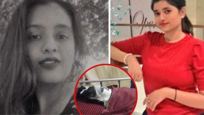 MP News: दोस्ती ने लिया खौफनाक मोड़, ईर्ष्या में डूबी युवती ने कर दिया तेजाब से हमला