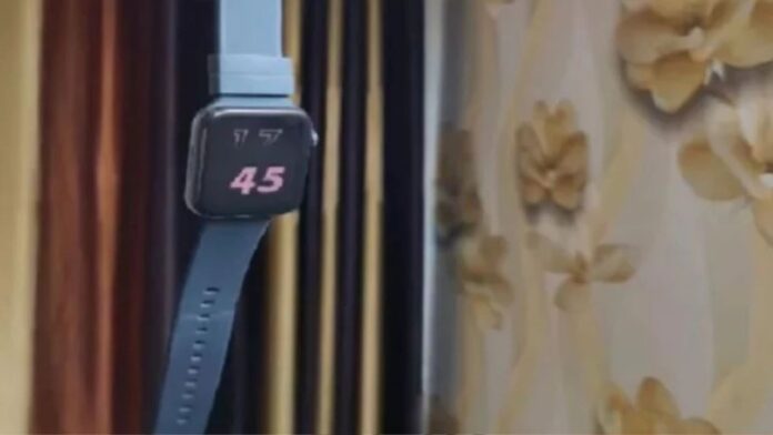 MP News: इटारसी शादी समारोह में बड़ा हादसा स्मार्ट वॉच फटने से दो बच्चे झुलसे